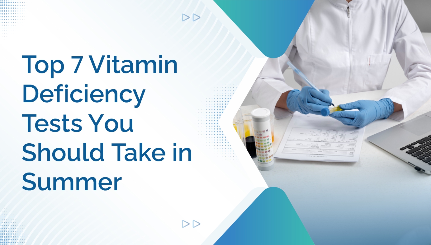 https://ampath.com/category/922_18. Top 7 Vitamin Deficiency Tests You Should Take in Summer.jpg